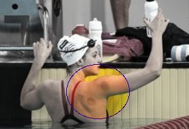 Athlete With Cupping Marks on Shoulder